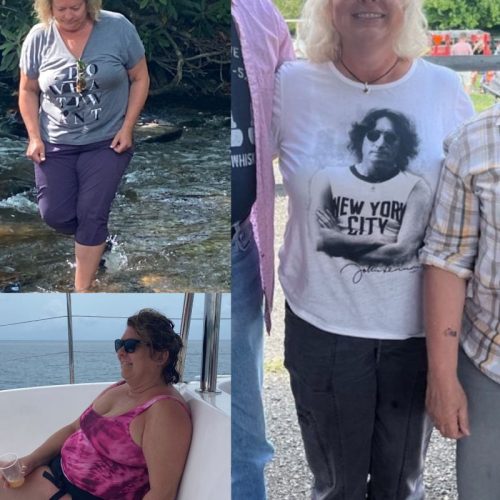 weight loss before and after at Renew