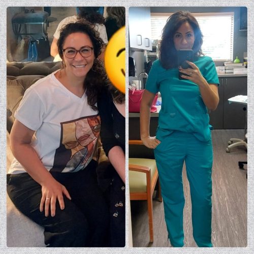 weight loss before and after